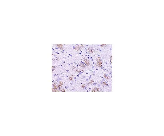 62-8473-76　Anti-KLHL1　ABT341