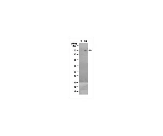 62-8522-89　Anti-phospho-MEKK5, Thr845, clone PA214　MABS494