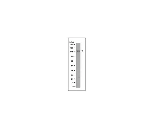 62-8523-81　Anti-CDKL5 Antibody, clone 8F3.1　MABS1132