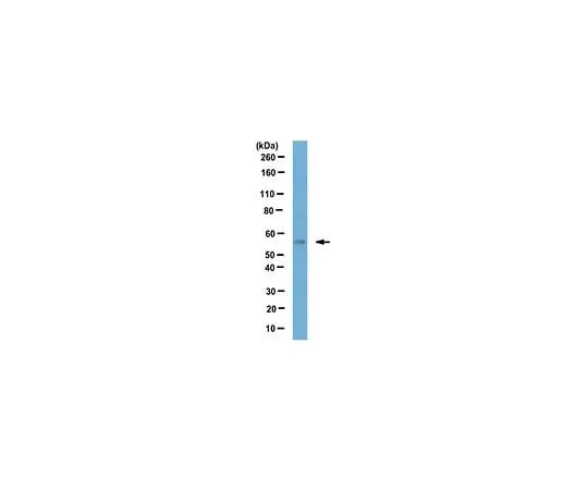 62-8470-59　Anti-S1P lyase Antibody　ABS528