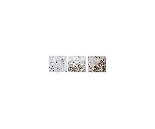 62-8516-47　Anti-Tdp43, clone 3H8　MABN45