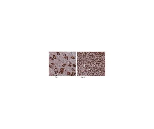 62-8472-74　Anti-T-cadherin (CDH13); 100 μg　ABT121