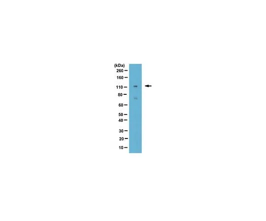 62-8470-69　Anti-MuSK　ABS549