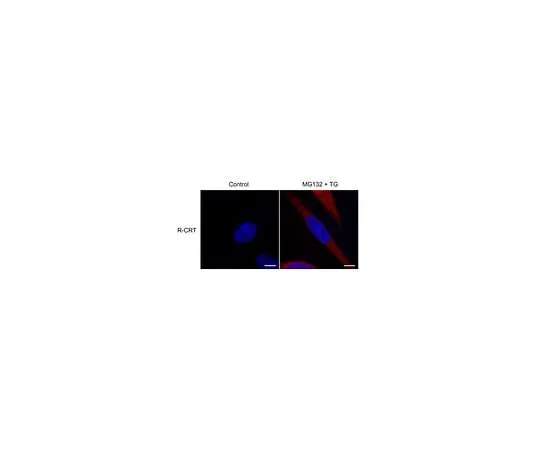 62-8472-01　Anti-Calreticulin Antibody, arginylated (Nt-Glu18)　ABS1671