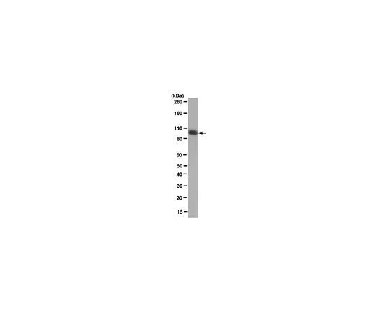 62-8501-56　Anti-Isocitrate Dehydrogenase 1 (IDH1)-R132H, clone HMab-1　MABC171