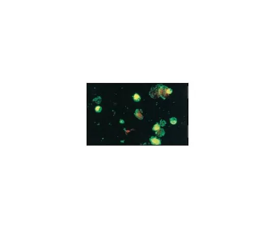 62-8490-10　Anti-Coxsackievirus A9, clone 450-11G-8A-5E; 100 μL　MAB947