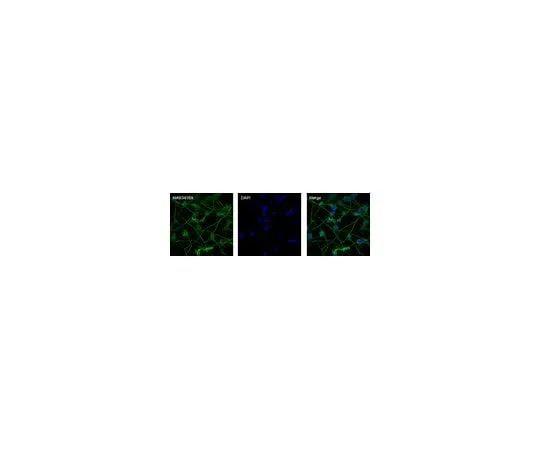 62-8494-87　Anti-MAP2, AlexaFluor(R) 488 conjugated; 100 μg　MAB3418X