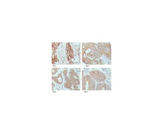 62-8526-81　Anti-Cytokeratin 18, clone 4D11E4 Antibody　MABT520