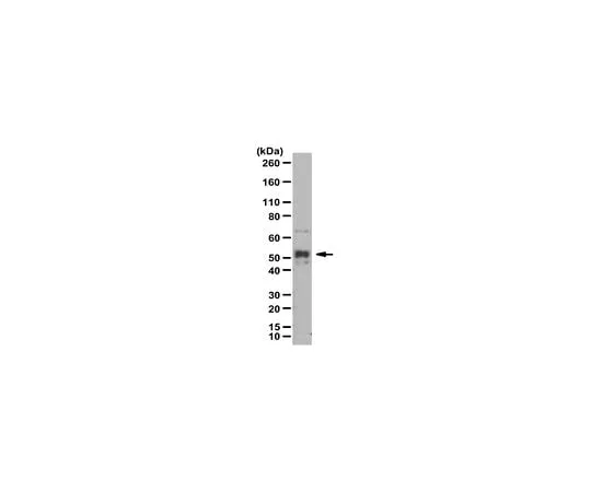 62-8471-63　Anti-phospho NF-kB p52, (Ser222)　ABS1515