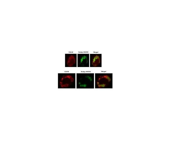 62-8471-79　Anti-CGI-58 Antibody　ABS1616