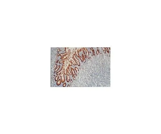 62-8492-85　Anti-Mucin MUC5AC, clone CLH2; 100 μg　MAB2011