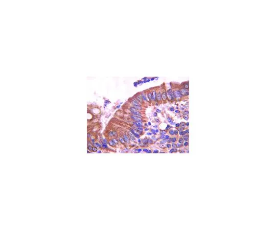 62-8525-19　Anti-E-cadherin, clone DECMA-1; 100 μg　MABT26