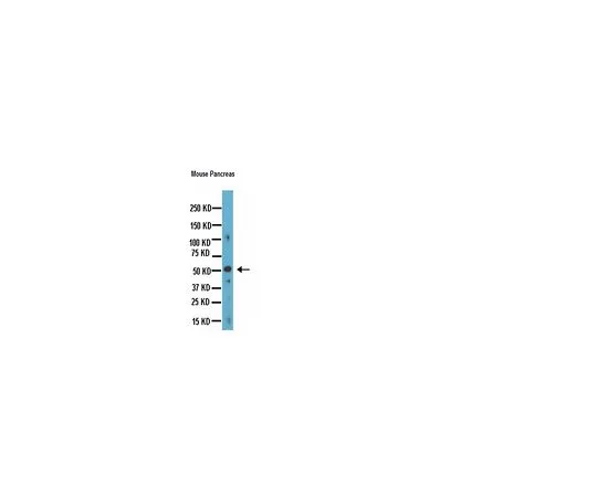 62-8497-37　Anti-Chromogranin A, clone LK2H10; 500 μg　MAB5268