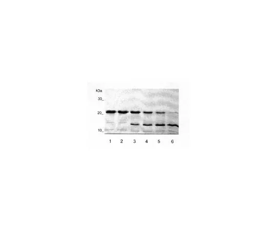 62-8480-67　Aggrecan Interglobular Domain, Recombinant, His-tagged; 50 μg　CC1890