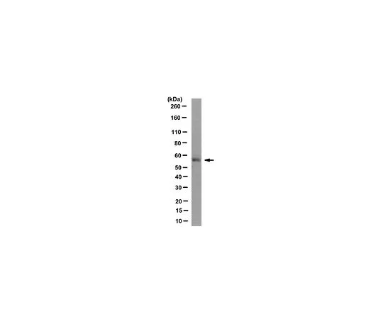 62-8502-40　Anti-HOIL-1 Antibody, clone 2E2　MABC576