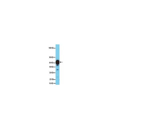 62-8497-43　Anti-Tyrosine Hydroxylase, clone 2/40/15; 40 μg　MAB5280