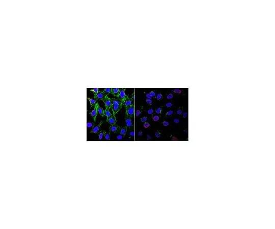 62-8495-71　Anti-phospho-ATM (Ser1981) Antibody, clone 10H11.E12, Ascites Free　MAB3806-C