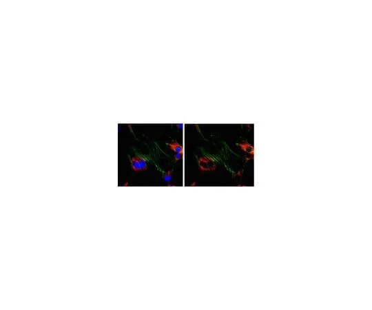 62-8472-49　Anti-Ena/VASP-like protein; 100 μg　ABT63