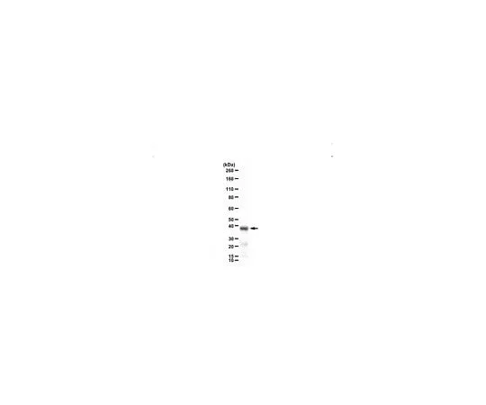 62-8468-88　Anti-SET-beta Antibody　ABN1738