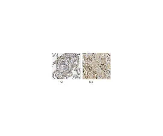 62-8519-34　Anti-PTK7, clone 4F9 MABN721　MABN721