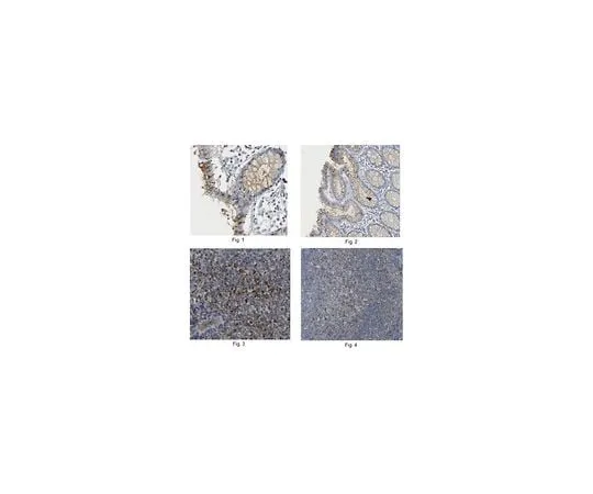 62-8525-72　Anti-Claudin-4, clone 10B4.3　MABT140