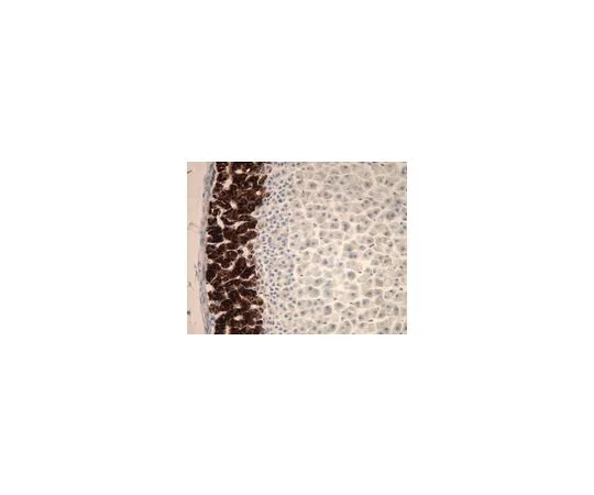 62-8498-58　Anti-Cytochrome P450 Aldosterone Synthase, clone 1G5; 500 μL　MAB6021