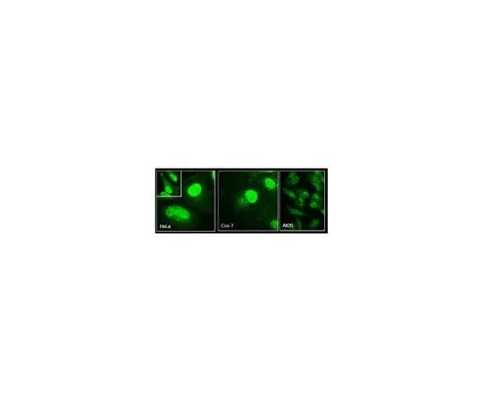 62-8473-07　Anti-Girdin Antibody, Cat. No. ABT168　ABT168