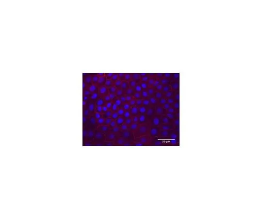 62-8526-23　Anti-CD167a/DDR1 Antibody, clone 5D5　MABT333