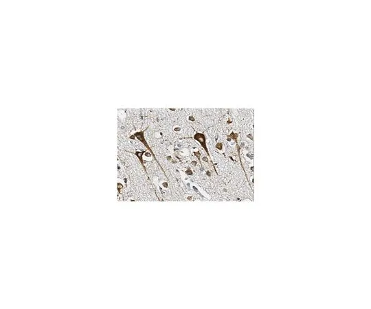62-8517-18　Anti-Beta-mannosidase　MABN279