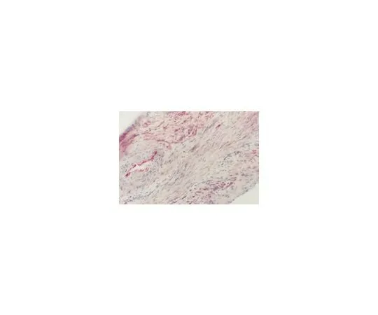 62-8495-91　Anti-Angiotensin Converting Enzyme, clone 9B9; 100 μg　MAB4051