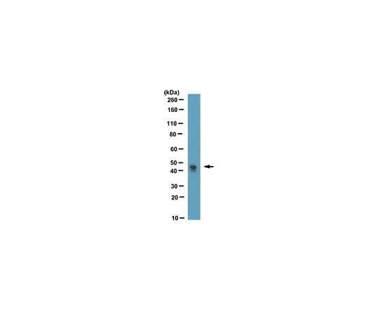 62-8527-36　Anti-HSV•Tag(R) Antibody, clone HSV 78, Cat. No. MAC123　MAC123