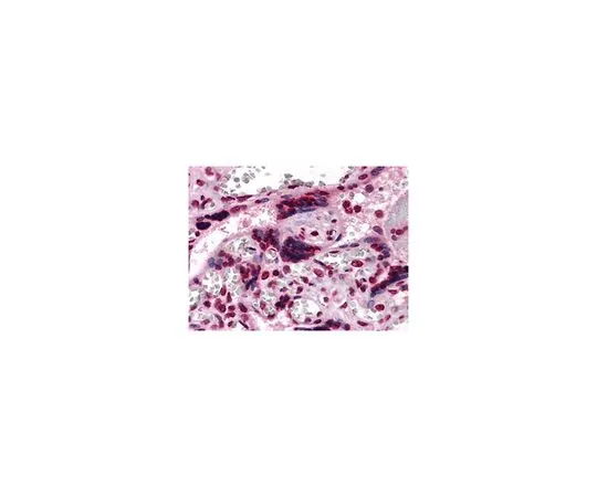 62-8509-19　Anti-CSF1, clone 2D10　MABF191