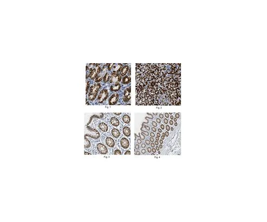 62-8525-63　Anti-AGR2 Antibody, clone 5G1.1 MABT122　MABT122