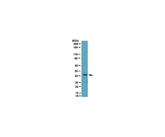 62-8472-28　Anti-Endophilin-A1; 100 μL　ABT22