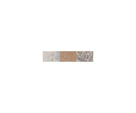 62-8468-35　Anti-Beta-glucocerebrosidase (GBA)　ABN1387