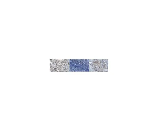 62-8524-64　Anti-asparagine synthetase Antibody, clone Z5808　MABS1300