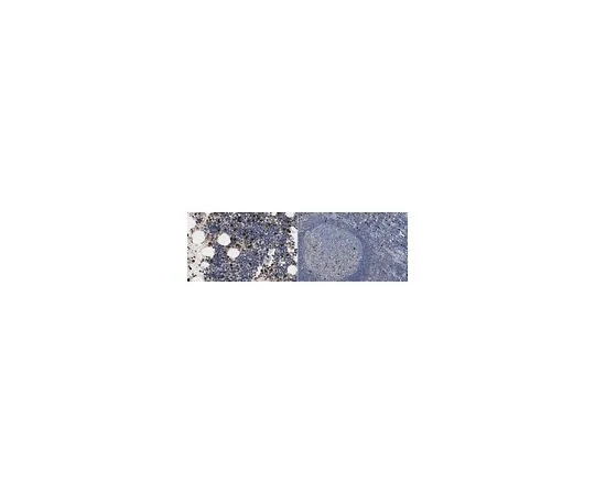 62-8526-91　Anti-MMP-9 Antibody, clone 3D6.3　MABT531