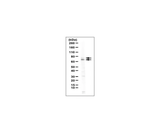 62-8471-28　Anti-MTHFR Antibody　ABS1013