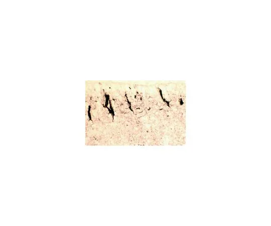 62-8497-70　Anti-Reelin, a.a. 164-189 mreelin, clone 142; 100 μg　MAB5366