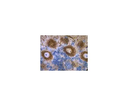 62-8516-39　Anti-pan-Shank, clone N23B/49; 100 μg　MABN24