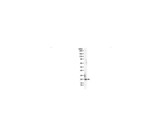 62-8472-05　Anti-VPS25　ABS1676