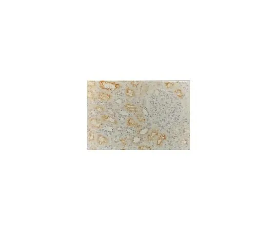62-8496-04　Anti-MDR1, clone JSB-1; 100 μg　MAB4120