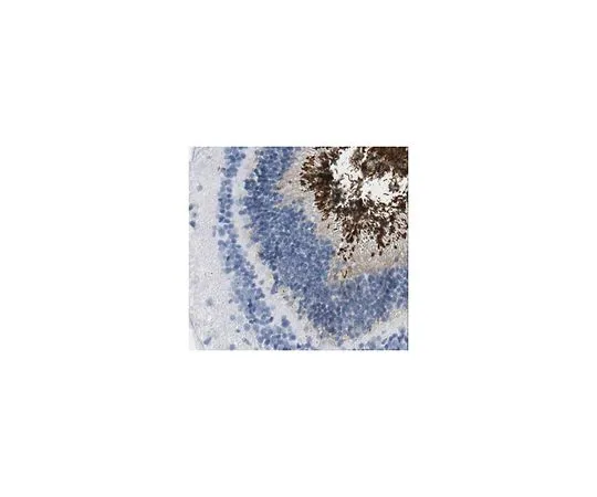 62-8517-24　Anti-Peripherin-2, clone 6B10.1　MABN293
