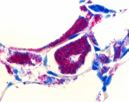 61-0314-70　Tb-Color Cold-Type Acid-Fast Bacteria Stain Set 116450 1Set　1.16450.0001