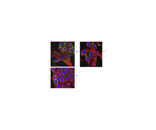62-8526-06　Anti-α-Tubulin, clone DM1A　MABT205