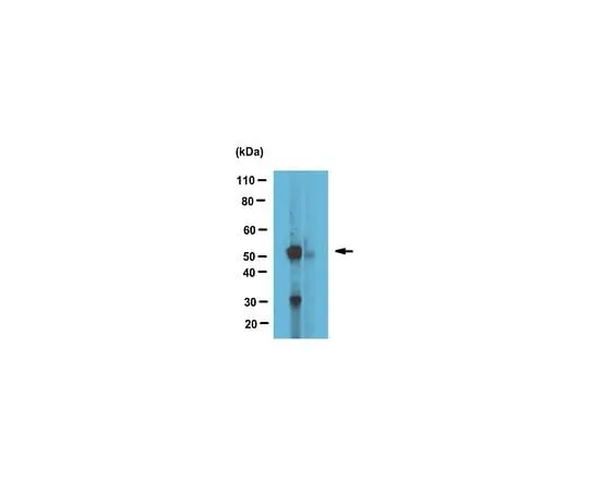 62-8473-09　Anti-alpha Tubulin Antibody, tyrosinated Cat. No. ABT171　ABT171