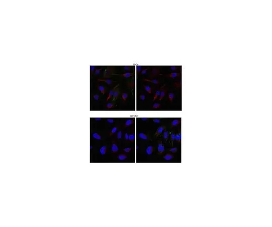 62-8472-94　Anti-Kinesin-like protein KIFC3　ABT151