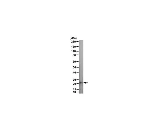 62-8468-60　Anti-p75NTR Antibody, ICD　ABN1655