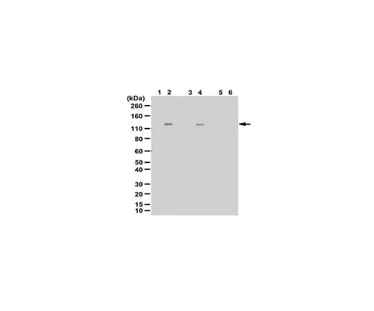 62-8469-67　Anti-phospho-DBC1 (Thr454)　ABS218