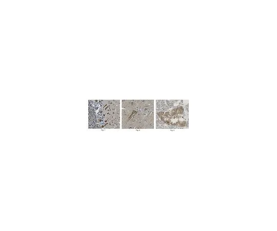 62-8519-96　Anti-Cav1.2 alpha1c, clone 8F9.1　MABN863